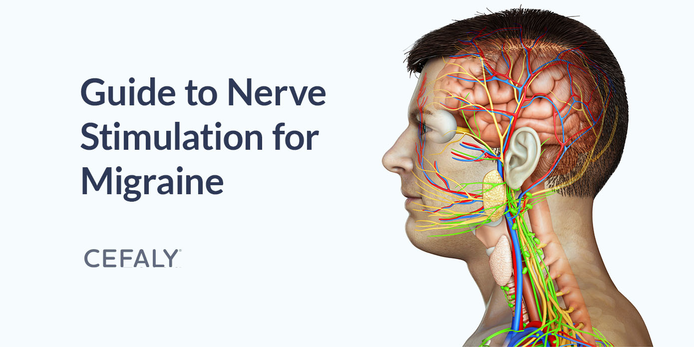 Guide to Nerve Stimulation for Migraine
