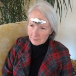 Living with CADASIL and Migraine: Barbara's Migraine Story Barbara’s Migraine Story